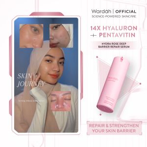 WARDAH Hydra Rose 14X Hyaluronic Pentavitin Deep Barrier Repair Serum 30 ml - Serum dengan Allantoin