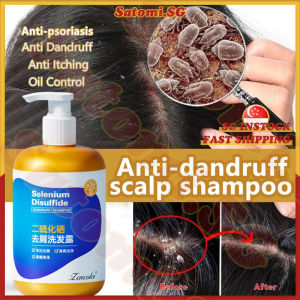 💄SG Stock💄 Selenium sulfide shampoo / Anti dandruff shampoo / Dandruff scalp treatment / Psoriasis anti fungal shampoo / 二硫化硒洗发水