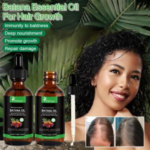 Batana Essential Oil For Hair Growth Anti-hair Loss Pure Batana Repair Damaged Dryness Frizz Hair Batana Serum