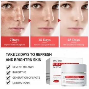 Zoo·Son Effective Freckle Cream Remove Dark Spots Witening Cream Fade Acne Scars Melasma Anti-Aging Skin Lightening - Cream Pemutih-wajah Glowing Krim-cream Penghilang Flek - Wajah Cream Siang Malam 50G