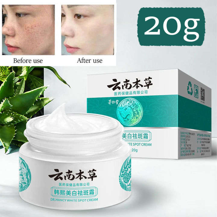 20g Japanese Melasma Cream Melasma Cream From Japan Yunnan Herbal Whitening Freckle Cream 5643