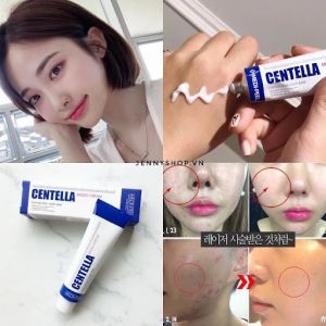 [HCM]Kem Đánh Bay Làm Sạch Mụn Phục Hồi Da Chiết xuất Rau Má Medi-Peel Centella Cream 30ml