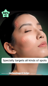 freckles removal serum dark spot remover  40ml Freckle cream whitening and removing black spot remover pigmentation black spot brightening moisturizing cream