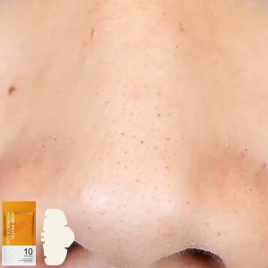 Hydrocolloid Pore Patch - 5pcs/Box Nose Patch For Cleansing Pores Removing Blackheads Acne Pimples Zits And Controlling Oil Safe & Non - Irritating
