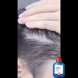 Dầu gội trị gàu và ngứa selenium disulfide 100% nguyên bản trị gàu và chống rụng tóc hương thơm lâu dài kiểm soát dầu dưỡng ẩm nhẹ không gây kích ứng 300ML