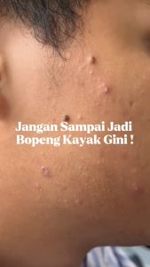 Cara Menggunakan Kahf Face Wash Oil & Perawatan Jerawat 100ml/50ml