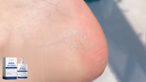 Oceaura Urea Foot & Hand Care Cream Stick – Deeply Moisturizes & Nourishes Dry Rough Skin Aloe Vera for Softening Dry Cracked Feet Gentle Exfoliation Daily Foot Care Solution (100g)