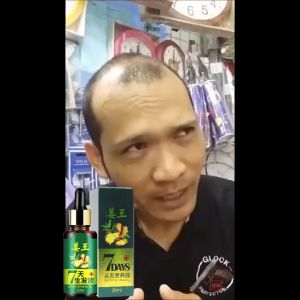Airan Essence SERUM MINYAK Penumbuh Rambut Anti Rontok Serum Obat kebotakan Nutrisi Rambut Jahe AMPUH DALAM 7 HARI