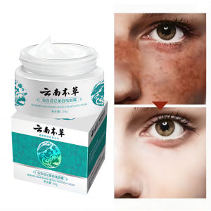 Melasma Faded Cream High Hydration Face Cream Melanin Cream White Spot Freckle Removing Cream Melasma Pigmentation Brightening Skin Tone Moisturizing 20g