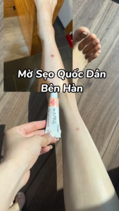 Kem Mờ sẹo lồi lõm làm mờ thâm trắng da Hàn Quốc Noscarna 20g Mẫu mới