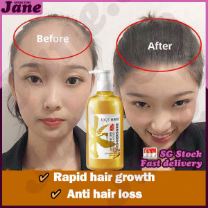 🎈𝙎𝙂 𝙎𝙩𝙤𝙘𝙠🎈  Hair loss shampoo / Ginger shampoo / Hair growth shampoo / Herbal extract anti hair loss shampoo / 防脱发洗发水 / 生姜洗发水