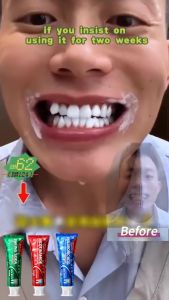BIOAOUA Toothpaste Baking soda Nicotinamide Whitening And Yellowing Removal Fresh oral cavity Soothing Toothpaste 100g