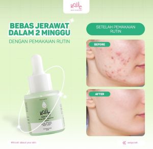 [OFFICIAL] KOJIC PLANKTON ACNE GLOW ESSENCE SERUM 20 ML