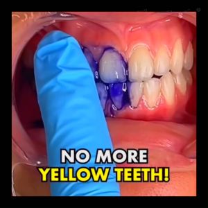 GlorySmile V34 Color Corrector Whitening Serum Toothpaste - Peroxide-Free 28-days Formula - Social Media Viral Instant Oral Whitening V34 Glory Smile V34 V34 Colour Corrector Where To Buy - Lazada