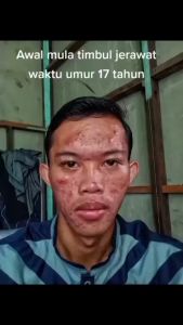 Sabun Arabel & Sabun Wajah Herbal: Solusi Jerawat & Flek Hitam