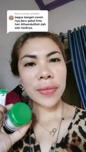 L:iz Skincare produk dari Dokter Listiani: Salep Darkspot Sensi Skin & Sunscreen