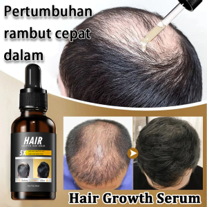 Hair Growth Serum Hair Nourishing&Repairing essence 30ml Hair Loss Prevention Herbal Essence Hair Line Repairing essence Hair Growth Anti dropping