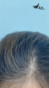 Combo 2 gói dầu gội phủ bạc tại nhà sau 5 phút YOUNG chiết xuất từ bồ kết hương thơm dễ chịu 30ml