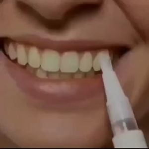 Dazzling Whitening Pen Pemutih Gigi Kuning Permanen Putih Pembersih Penghilang Plak Karang Dazzle