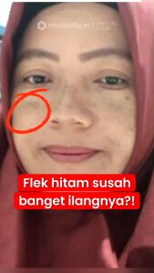 Paket Perawatan Wajah Flek Khusus Malam Hari Pharmaskin