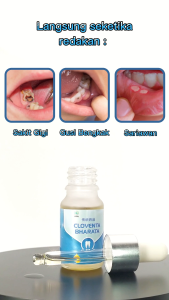 Obat Sakit Gigi dan Sariawan Ampuh Original | Obat Cepat Atasi Sakit Gigi Berlubang / Obat Penghilang Rasa Sakit Gigi Bersihkan Karang Gigi Obat Gusi Bengkak Hilangkan Bau Mulut Jaga Kesehatan Gigi dan Mulut | CLOVENTA BHARATA