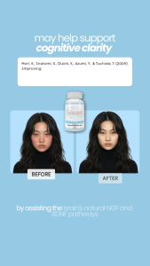 Nootropicsnow Lion’s Mane Mushroom 500mg 8:1 Extract 60 Capsules Brain Booster for Memory NGF and Cognitive Health