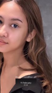 Paket Skinmology 5in1 Lightening Booster Series