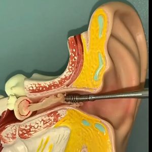 Set 6pcs Korek Kuping Pembersih Telinga Ear Wax Picker Paket Alat Pembersih Kuping Stainless steel 8007