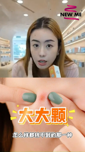 祛痘凝胶 New Me Acne Spot Gel【 双11疯狂抢福利！】 [买三送一/BUY 3 FREE 1] Acne Gel New Age Skin Care Reviews - Lazada
