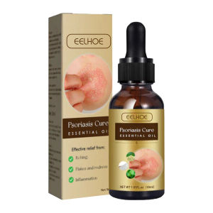 Eelhoe Psoriasis Antibacterial Serum Anti Itching Dermatitis Eczema Treatment Hydrating Eliminating Inflammatory Serum Skin Psoriasis Repair Essential Oil Anti Itch Swelling Hand Foot Dermatitis Antibacterial Relieve Itching Eczema Care