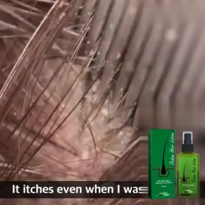 Hair Growth Spray Anti Hair Loss Baldness Hair Root Repair Damaged Scalp Treatment Serum Liquid Thickening Longer Beauty Health