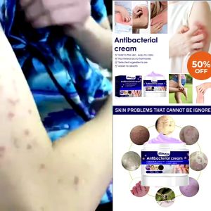 EFFECTIVE!!! South Moon Antibacterial Cream | Eczema Cream 30 g | Skin Itching Cream Herbal Antibacterial Agent External Use | Psoriasis Cream Anti-itch Relief Eczema Skin Rashes | Effective use