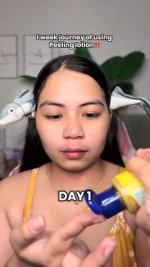 【BUY 1 TAKE 4】Skeencare Peeling Lotion For Face and Body and Dark Spots and Stretch Marks