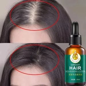 Semprotan Penumbuh Rambut & Serum Hair Growth: Mencegah Kebald dan Perbaikan Rambut Rontok