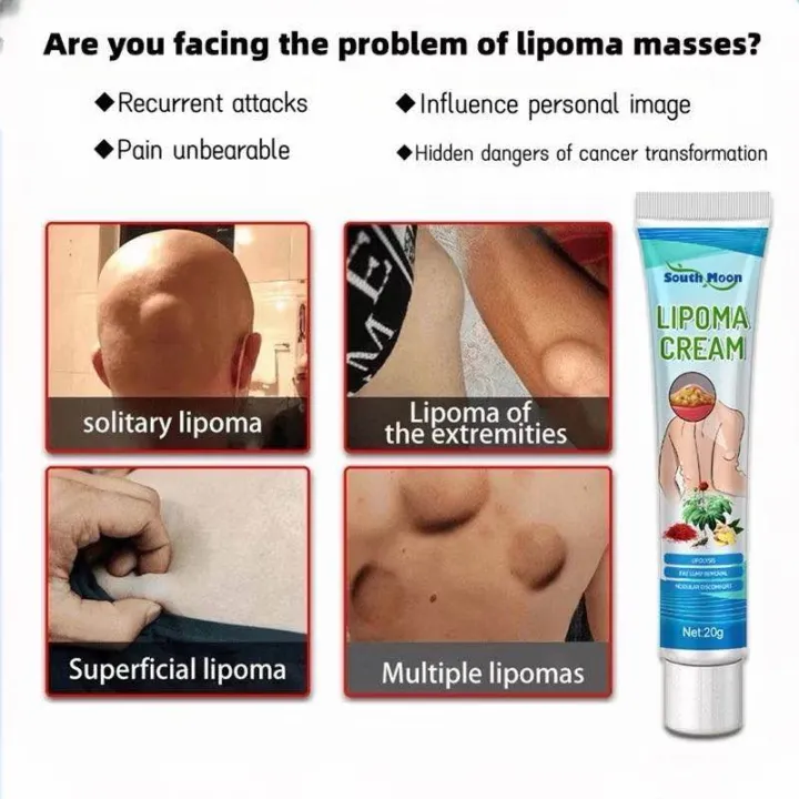 SOUTHMOON%20LIPOMA%20REMOVAL%20CREAM%20krim%20pembersih%20lipoma%20limfa%20ketulan%20keras%20ketiak%20leher%20belakang%20telinga%20buang%20detox%20badan%20-%20Image%208