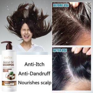 SADOER Natural Coconut Shampoo Hair Growth Anti Hair Loss Nourishing Coconut Oil Scalp Care Relieve itchy scalp Hair Care 500g 椰子去屑防脱发洗发水