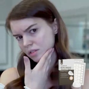 Spot Patches To Lighten Spots Red Spots Acne Marks Closed Comedones Blemishes Cover Spots Repair Patches Set