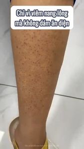 DR.FU - Kem dưỡng ẩm loại bỏ á sừng viêm lỗ chân lông đào thải bụi bẩn 20g