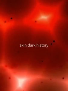 Kem diệt tàn nhang ngừa nám Chuyên sâu Loại bỏ các đốm đen Sắc tố làm sáng da