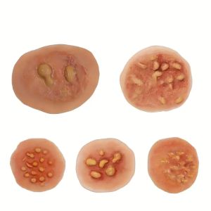 Sheet Boil/Blister Moulage  Scars Fake Scar Terror Wound Scary Blood Simulated Combat Injuries FX Mass Casualty Combat Simulation Horror Effects Fake Blister Detailed Design Burn