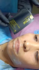 Miếng dán ủ tê môi POW chính hãng hộp 12 miếng