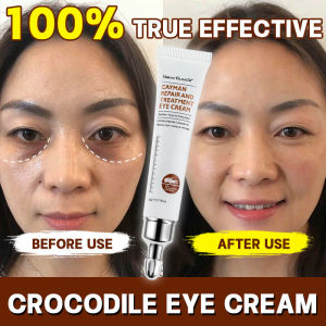 eyebag remover eye cream for eyebags remover original eye cream anti aging eyebag remover for men eye cream for dark under eye eye patch for eyebags remover eyebag cream celyn instant eye tightener cream moisturizer collagen eye cream serum
