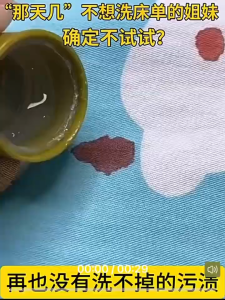 Laundry Stain Remover for Clothes | Removes Oil Fruit Milk & Food Stains