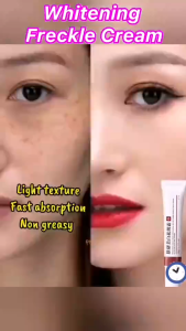whitening and freckle removing cream 20g nicotinamide moisture beauty salon Skin Care/skin care whitening freckle 美白祛斑霜20g烟酰胺保湿美容院护肤/皮肤护理美白祛斑