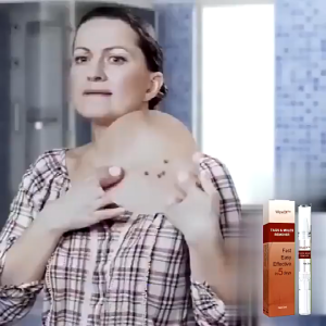 Warts Remover Wart Removal Liquid Pen Tags Moles Remover Pen Mole Remover Tags Remover Painless Mole Warts Freckle Remover Machine Facial Body Freckle Wart Dark Spot Skin Blackhead Blemish Pimple Treatment Liquid Skin tag remover Removal Melanin Spots