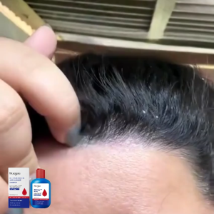 Selenium Disulfide Shampoo: Deep cleanses removes dandruff relieves itchy scalp balances oil production and adds volume to hair