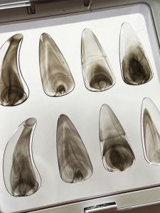 Premium Nan Molecule Guzheng Nails for Beginners And Adults Performance Level Children And Adults Can Use Ideal for Exams