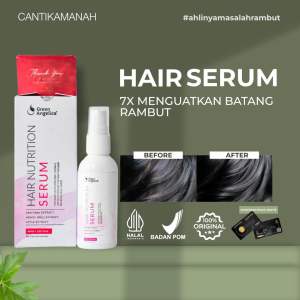 Cantik Amanah Serum Penumbuh Rambut Botak Mengatasi Kerontokan dan Ketombe yang Membandel Penumbuh Rambut Anti DHT Untuk Rambut Bercabang Kering dan Berminyak Green Angelica Dalam 7 Hari