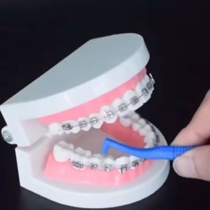 20pcs TEPE Angle Interdental Brushes Tooth Flossing Head Hygiene Dental Plastic Interdental Brush Toothpic Tooth Brush Cleaner Teeth Stick Dental Hygiene Tools