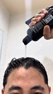KORMESIC Minoxidil Hair Shampoo with Biotin 300ml for Hair Growth Anti-Hair Loss and Dandruff Control